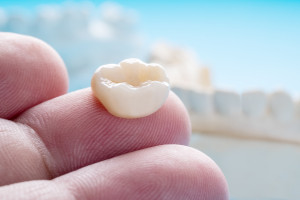 Prosthodontics or Prosthetic
